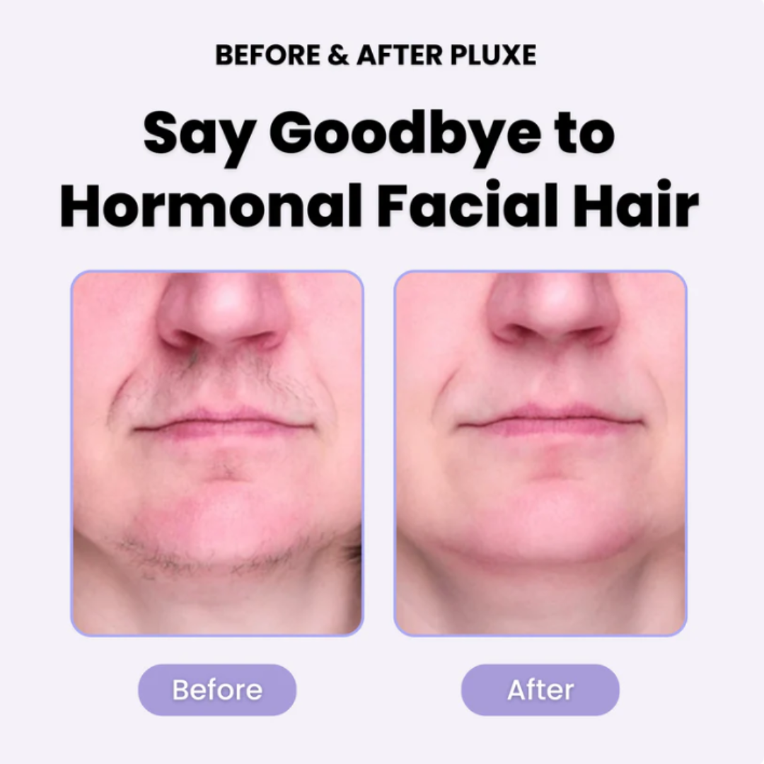 HEALER™ Facial Hair Remover